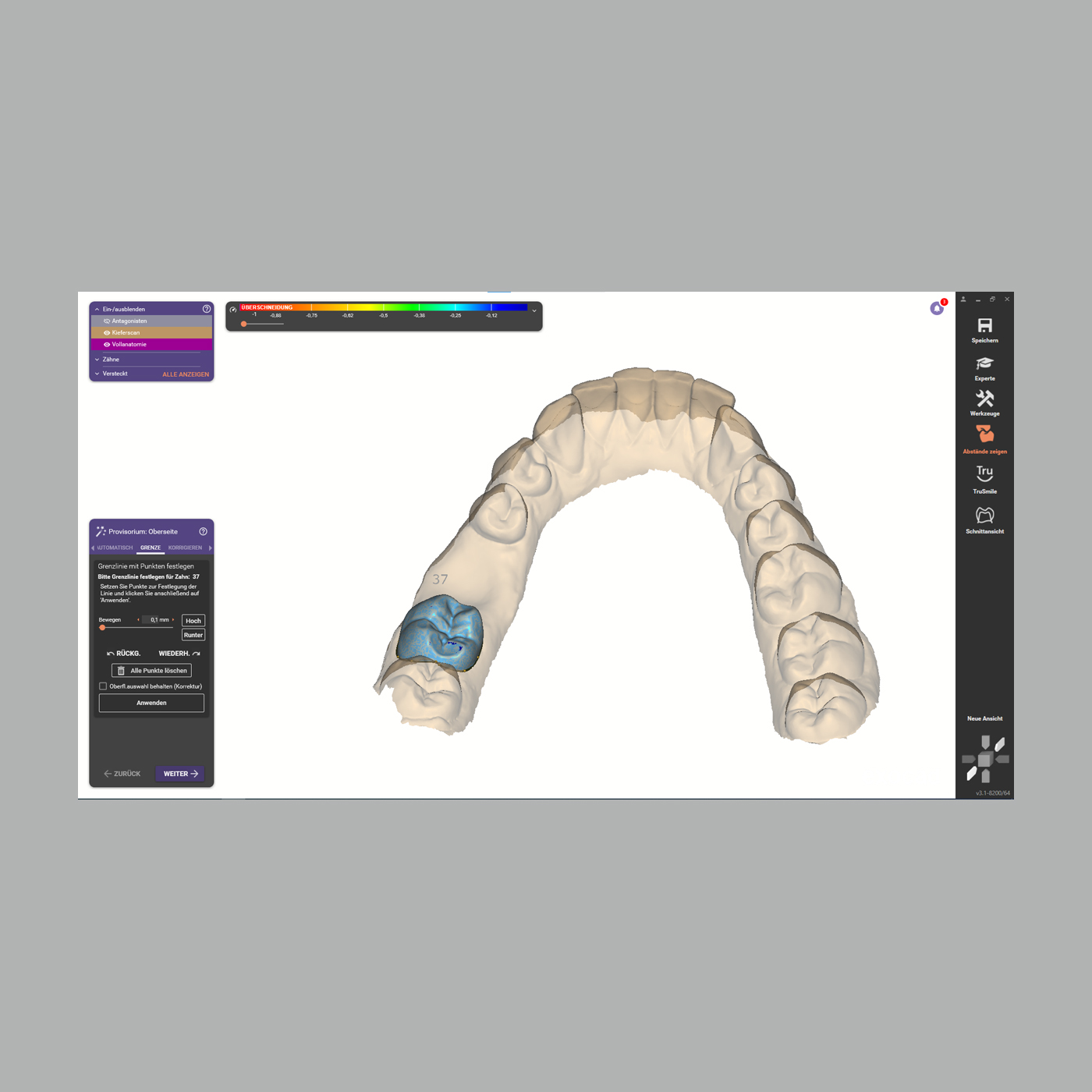 FINO DENTALART Provisorienmodul