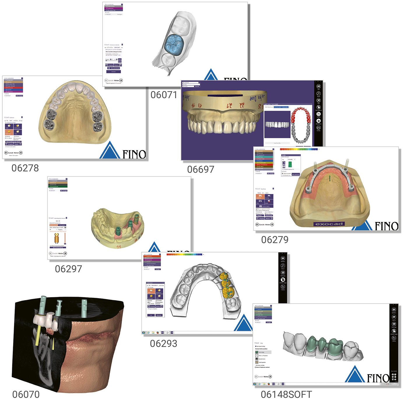 FINO DENTALART Implant Lab Bundle Flex Lizenz