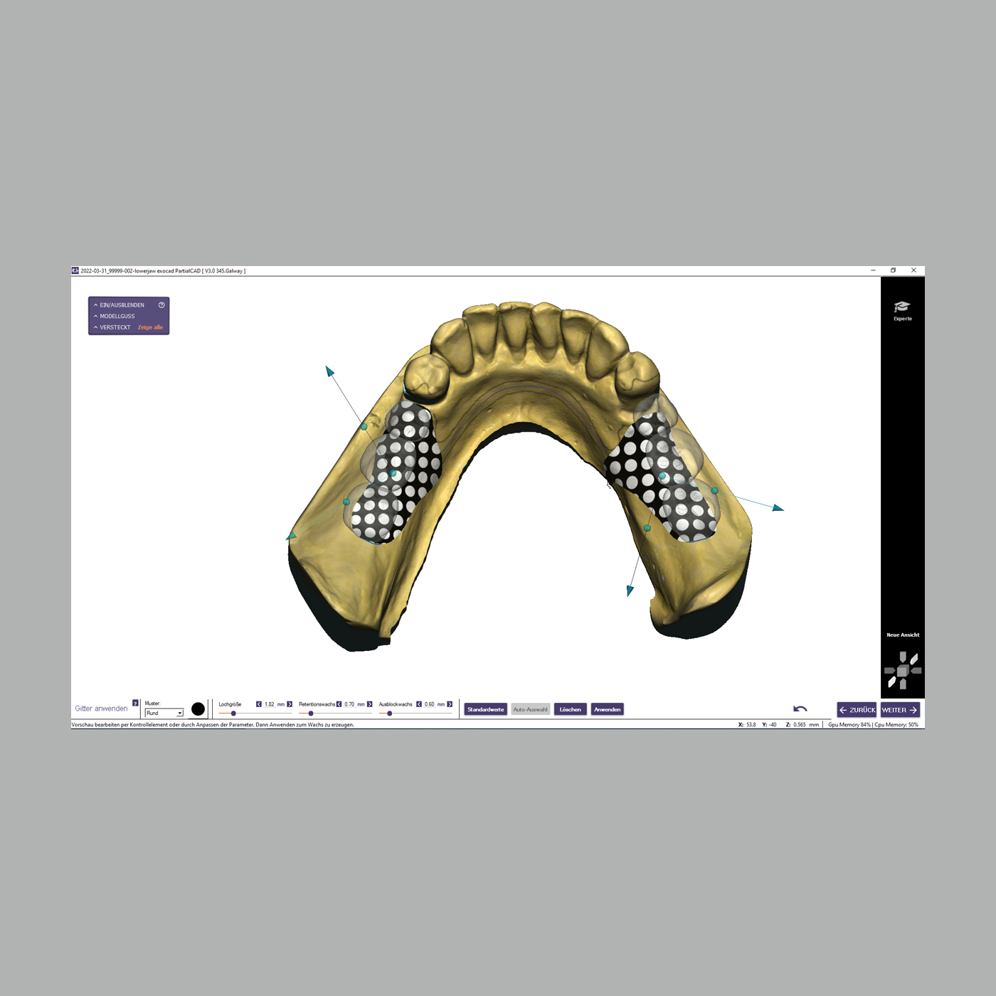 FINO DENTALART Modellgussmodul