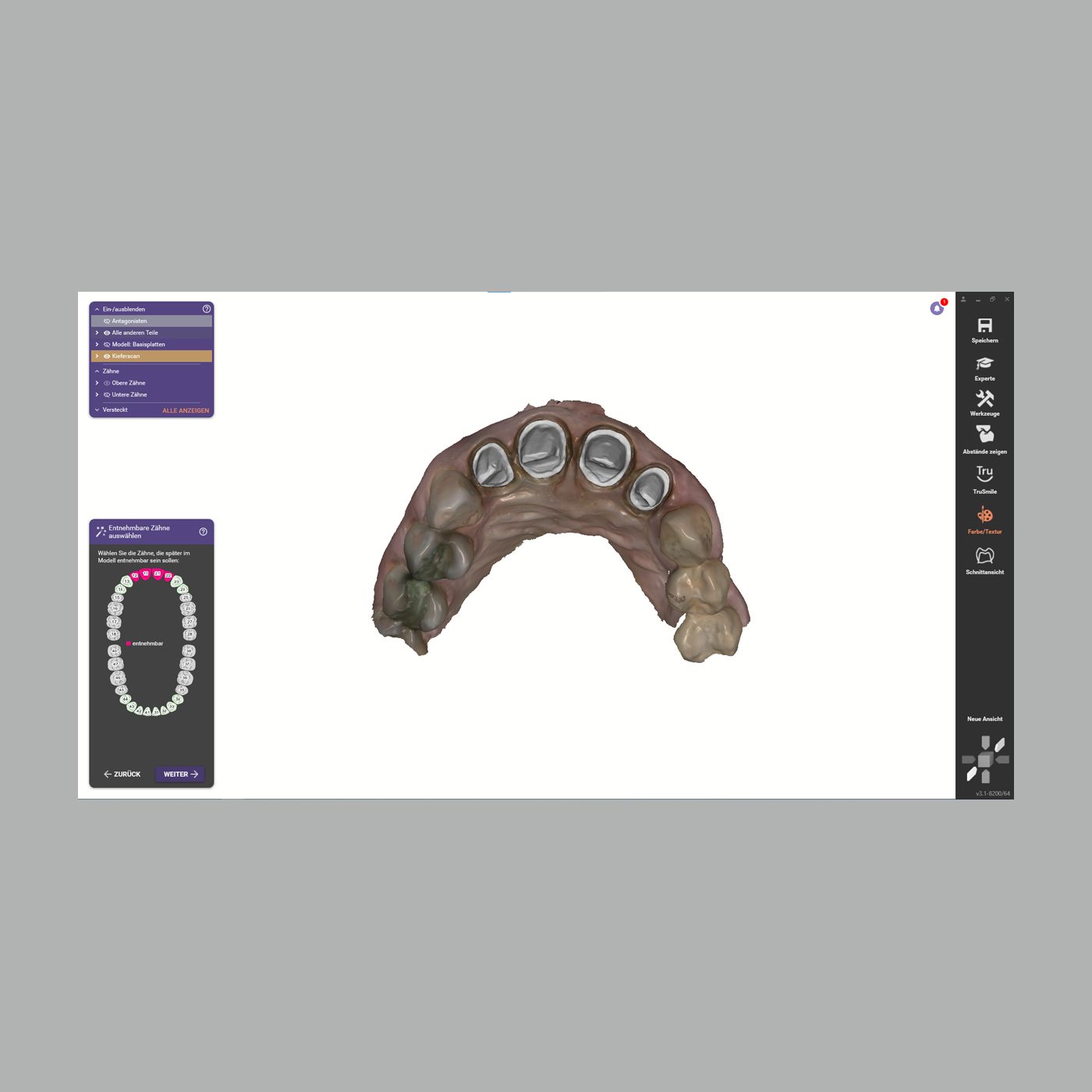 FINO DENTALART ModelCreator