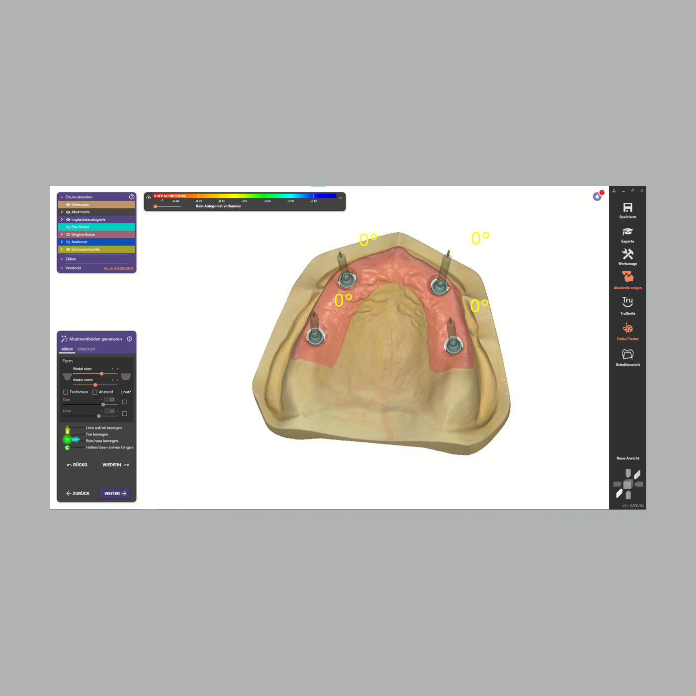 FINO DENTALART Stegemodul