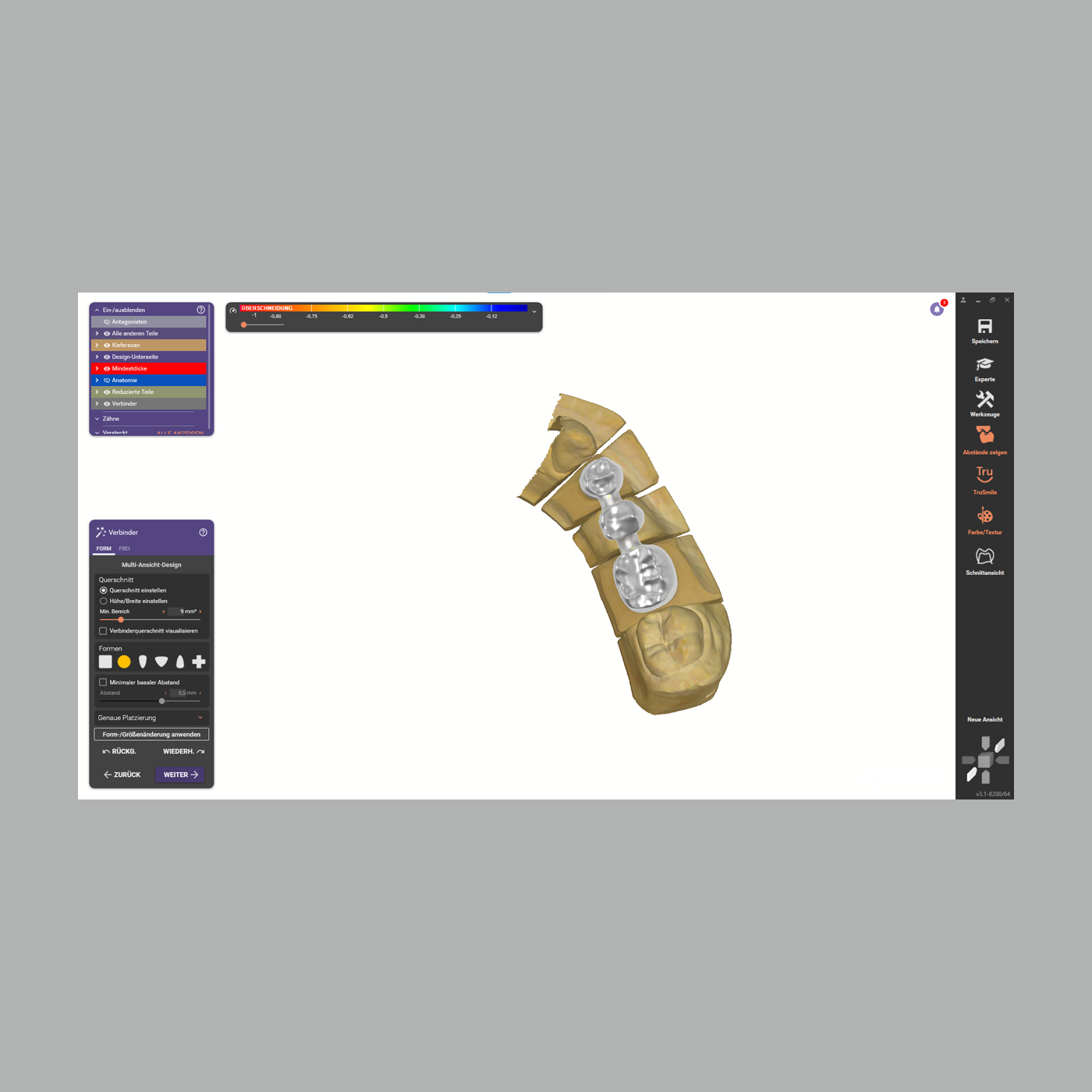 FINO DENTALART TrueSmile Softwareerweiterung