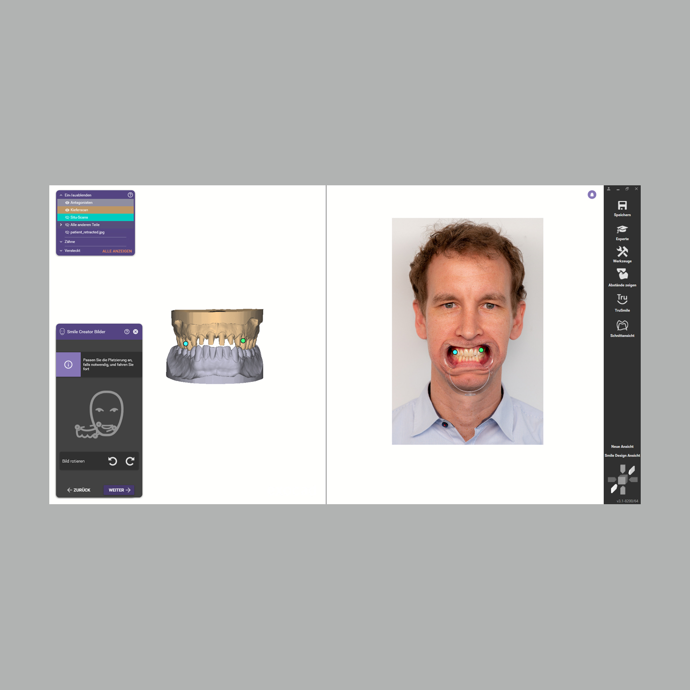 FINO DENTALART SmileCreator