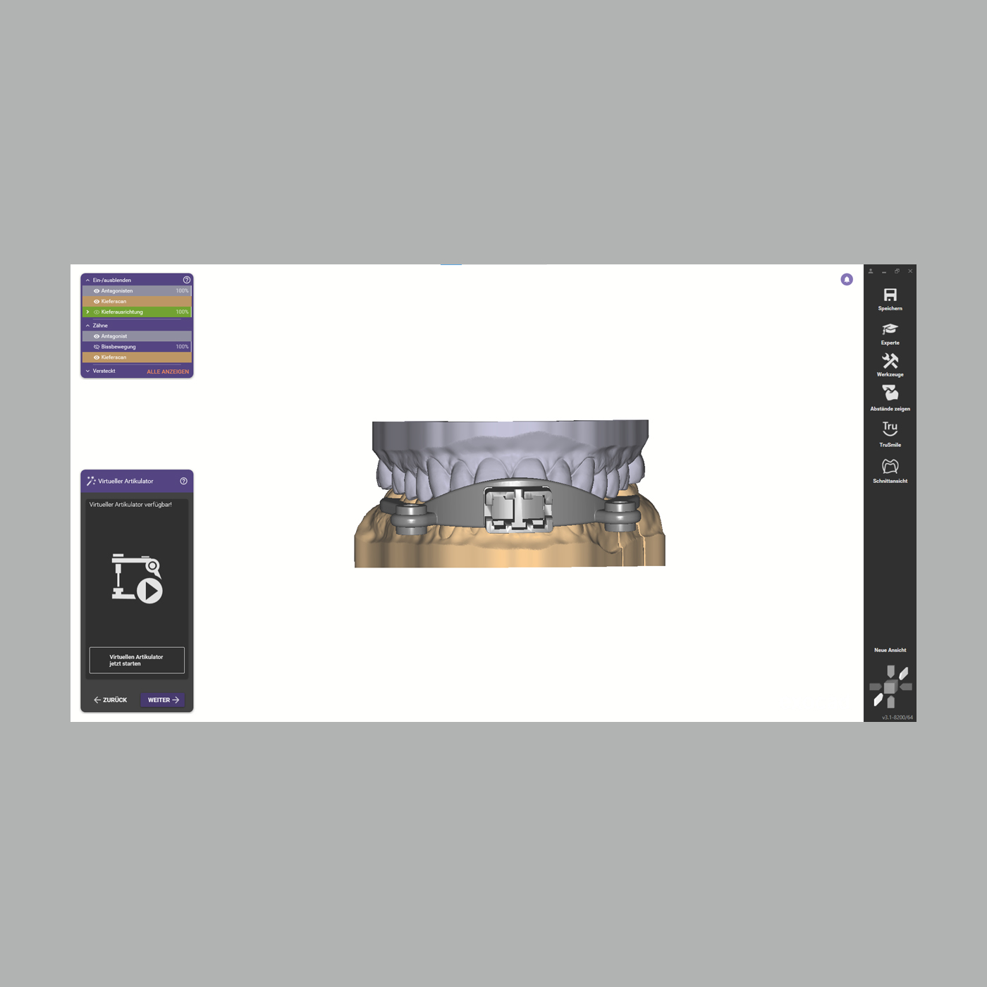 FINO DENTALART Jaw Motion Import