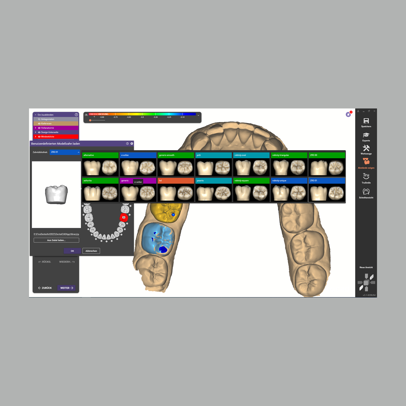 FINO DENTALART Tooth Library ZRS Wiedmann